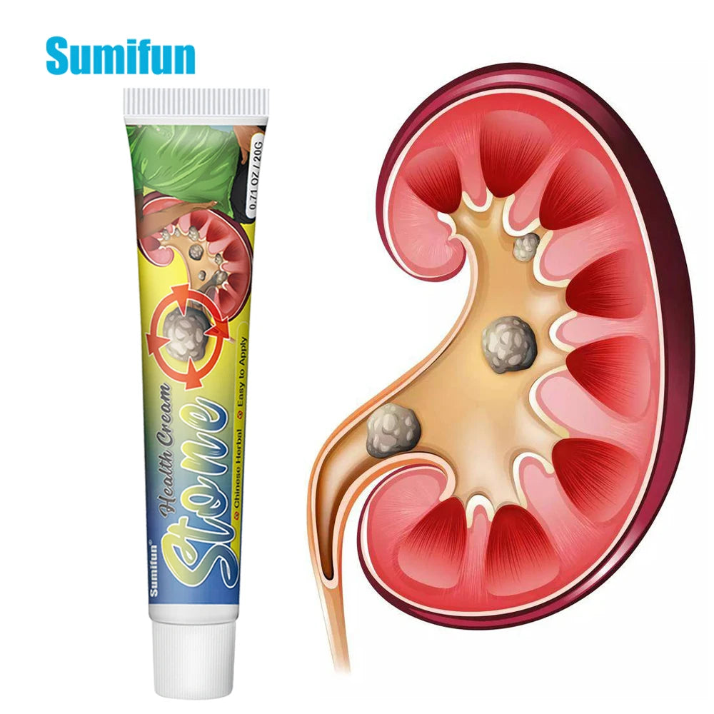 Sumifun 20g Renal Kidney Gallstone Treatment Cream Waist Abdominal Pain Urination Interruption Lithiasis Ointment Health Care