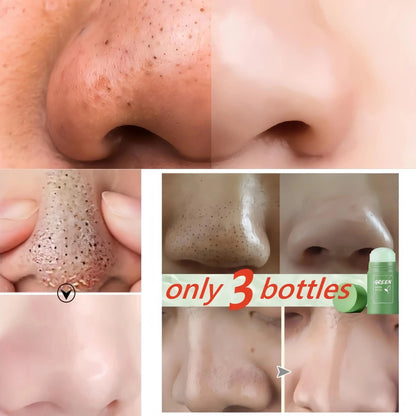 Original Facial Remove Blackhead Green Tea Solid Mask Treat Acne Blemish Black Dots Clean Stick Cream Shrink Pores Skin Care  ﻿