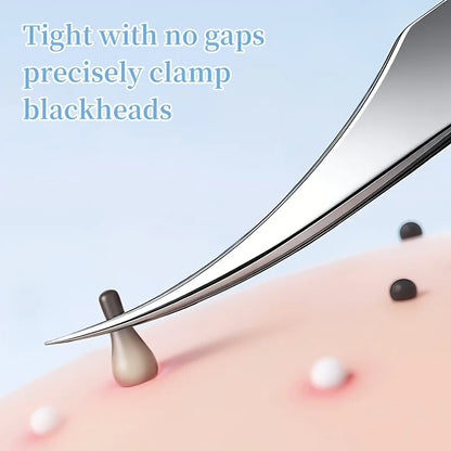 3pcs Professional Blackhead Tweezers - Ultra-Thin Tip, Stainless Steel Tweezers for Whiteheads, Ingrown Hairs And Facial Removal