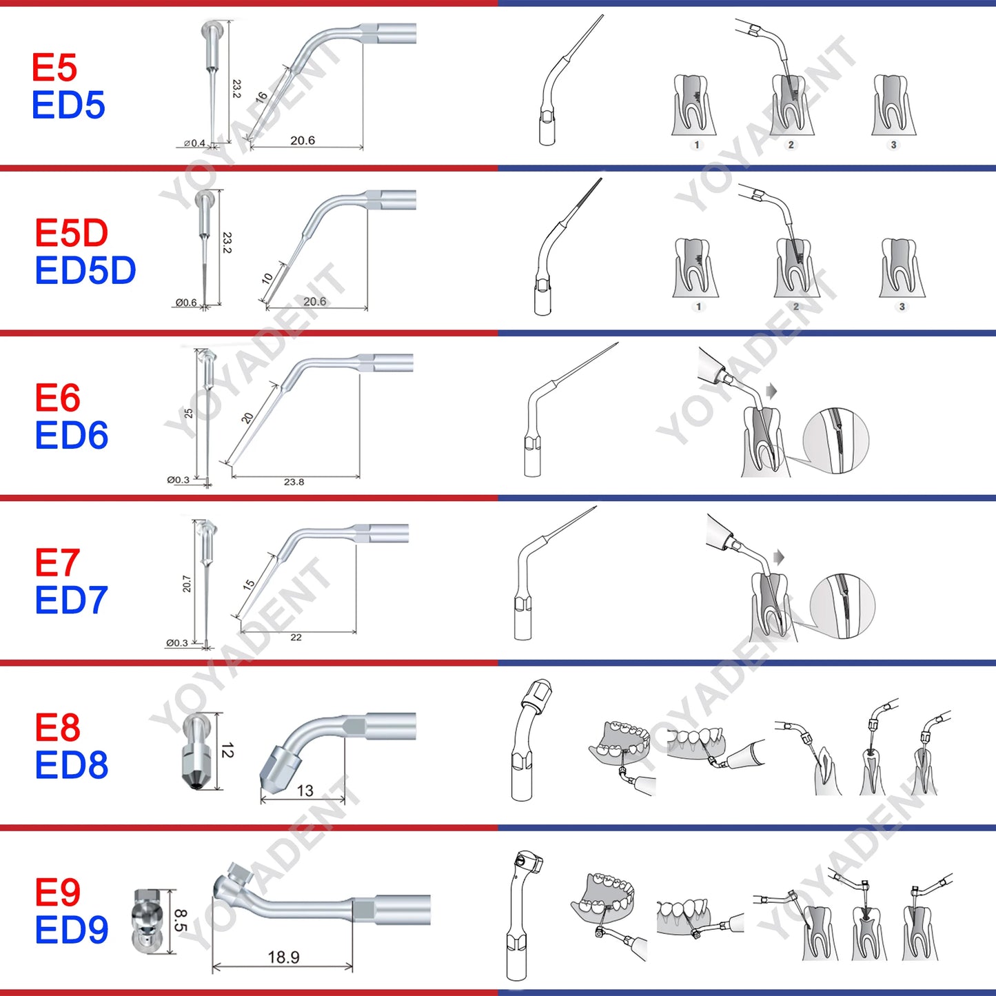 Woodpecker DTE Dental Endo Tips Ultrasonic Scaler Tips Scaling Tips ED-Series Fit NSK SATELEC Scaler Handpiece Dentistry Product