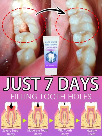 Rapid Relief Tooth Care Gel Comfort Oral Discomfort Clean Dental Plaque Maintain Fresh Breath Teeth Repair Paste For Daily Use