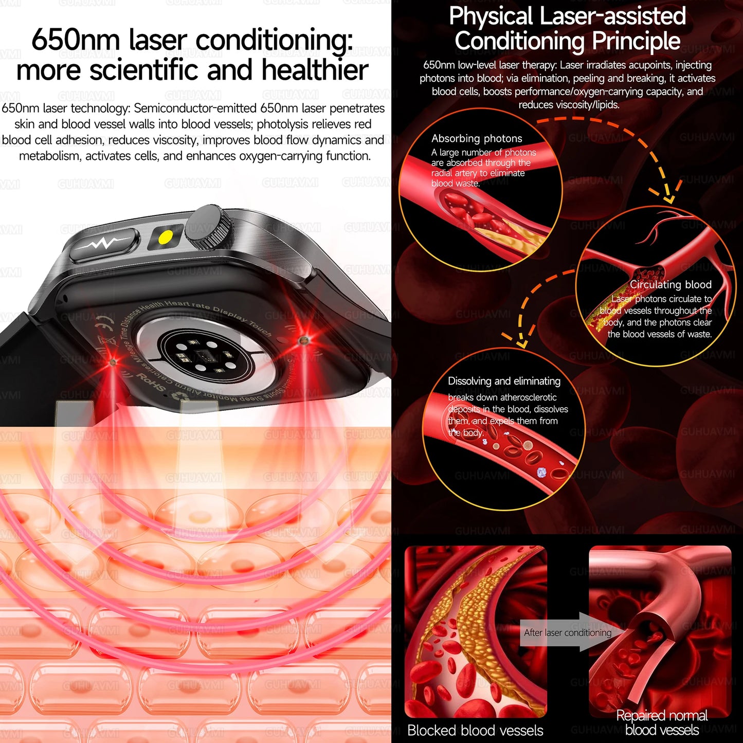 GUHUAVMI New Laser Therapy ECG+PPG Smart Watch Health Monitor Blood Lipids Uric Acid Heart Rate Tracking Monitoring Smartwatches