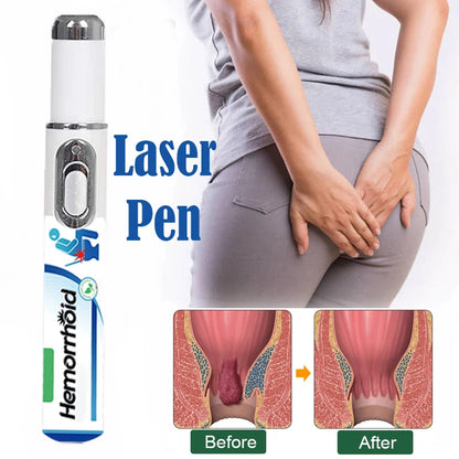 Hemorrhoid Medical Laser Pen Repair Anal Soft Tissue Stop Bleeding Effective Anti Swelling Pain Relief Laser Pointer Health Care