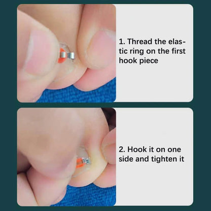 Toenail Correction Foot Care Tool Ingrown Toenail Corrector Tools Pedicure Recover Embed Toe Nail Treatment Professional