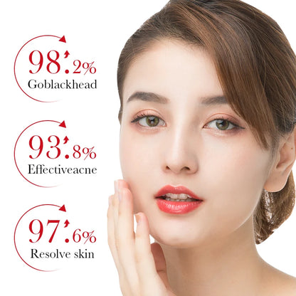 35ml BIOAOUA Salicylic Acid Anti-Acne Removal Essence Regulate Oil Secretion Improve Acne Of Skin Smooth Skin Blackhead Removal