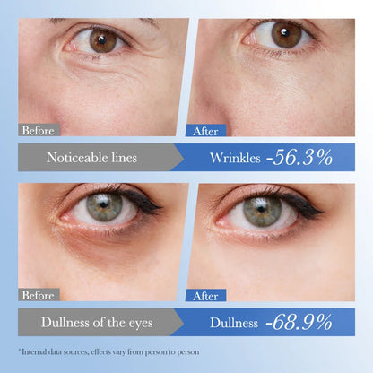 Caviar Eye Bag Removal Cream Hyaluronic Acid Anti-Wrinkle Firming Skin Fade Fine Lines Anti Dark Circle Puffiness Eye Care 20g