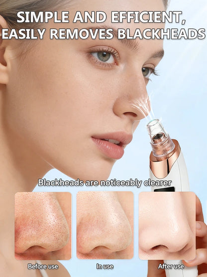Electric Blackhead Remover Vacuum Cleaner Black Dots Vacuum Cleaner Skin Pimple Acne Extractor Facial Cleaning Electric