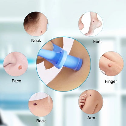 2-IN-1 Innovative Skin Tag Remover Kit Micro Skin Tag Removal Device Adult Mole Stain Wart Remover Face Care Beauty Tools