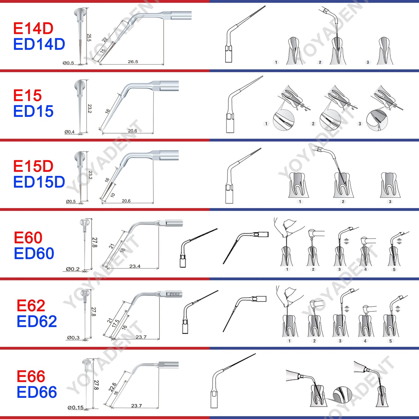 Woodpecker DTE Dental Endo Tips Ultrasonic Scaler Tips Scaling Tips ED-Series Fit NSK SATELEC Scaler Handpiece Dentistry Product