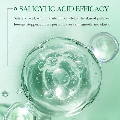 35ml BIOAOUA Salicylic Acid Anti-Acne Removal Essence Regulate Oil Secretion Improve Acne Of Skin Smooth Skin Blackhead Removal