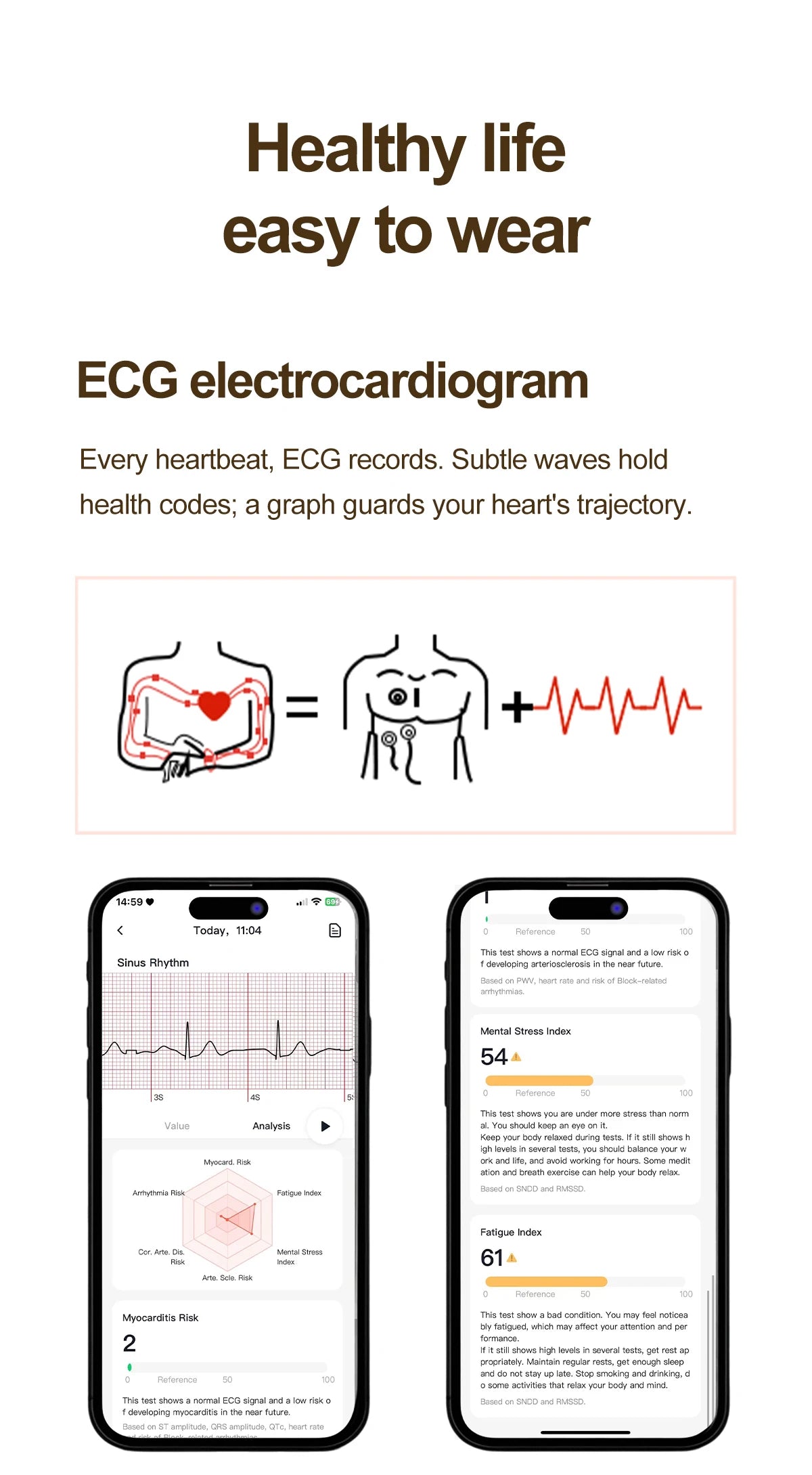 2026 New Women's Health Care Smartwatch ECG Blood Pressure Uric Acid Blood Lipids Sports IP68K Bluetooth call Fashion Smartwatch