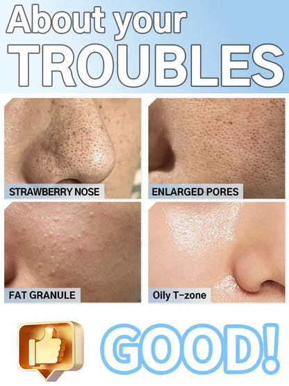 Electric Blackhead Remover Vacuum Cleaner Black Dots Vacuum Cleaner Skin Pimple Acne Extractor Facial Cleaning Electric