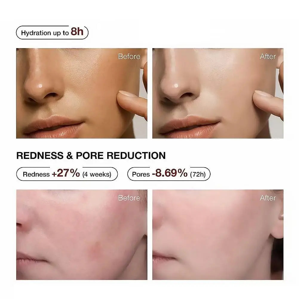 Teashell Serum 5% Niacinamide & Arbutin 30ml Fade Dark Spots Skin Moisturizing Hydration Sensitive Skin
