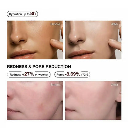 Teashell Serum 5% Niacinamide & Arbutin 30ml Fade Dark Spots Skin Moisturizing Hydration Sensitive Skin