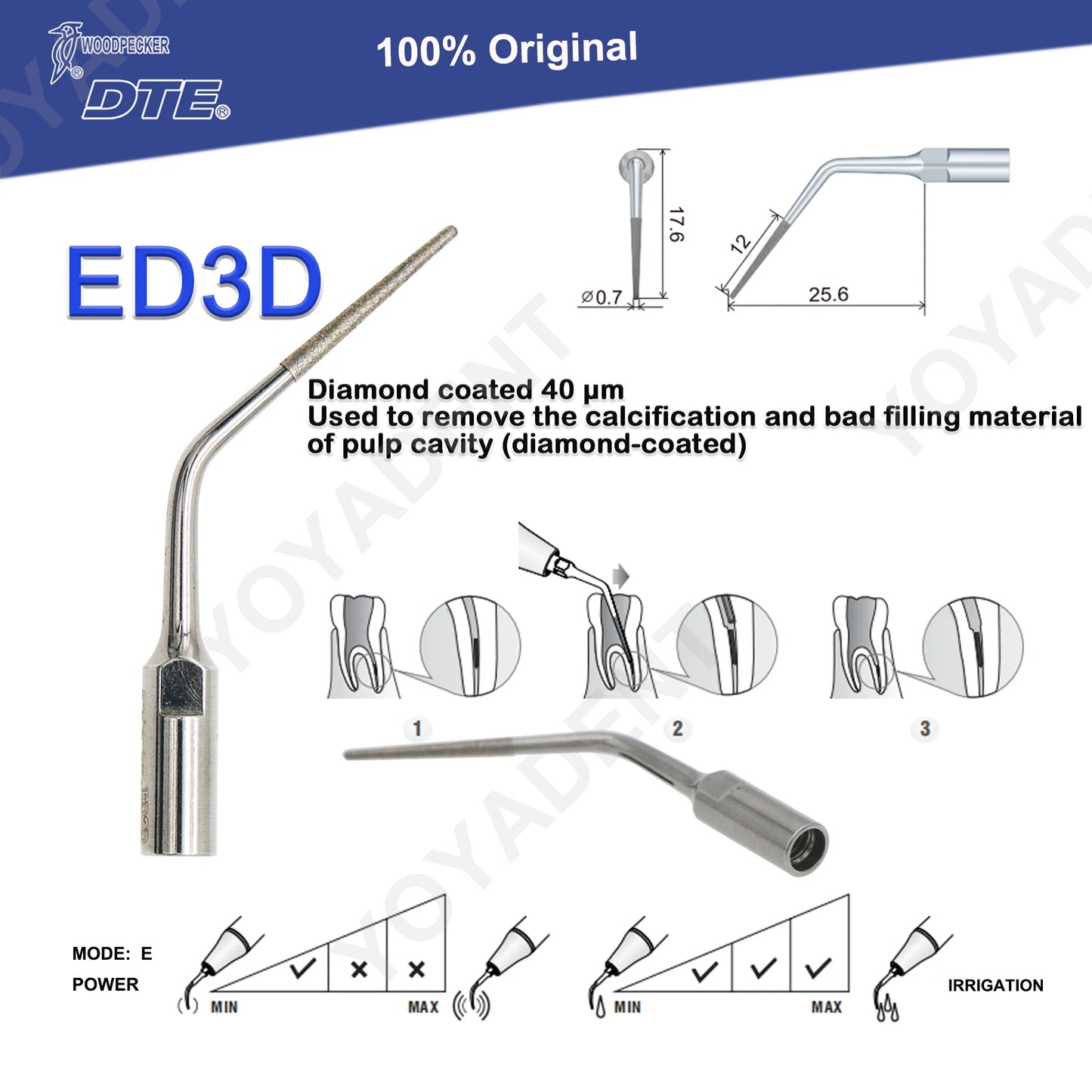 Woodpecker DTE Dental Endo Tips Ultrasonic Scaler Tips Scaling Tips ED-Series Fit NSK SATELEC Scaler Handpiece Dentistry Product