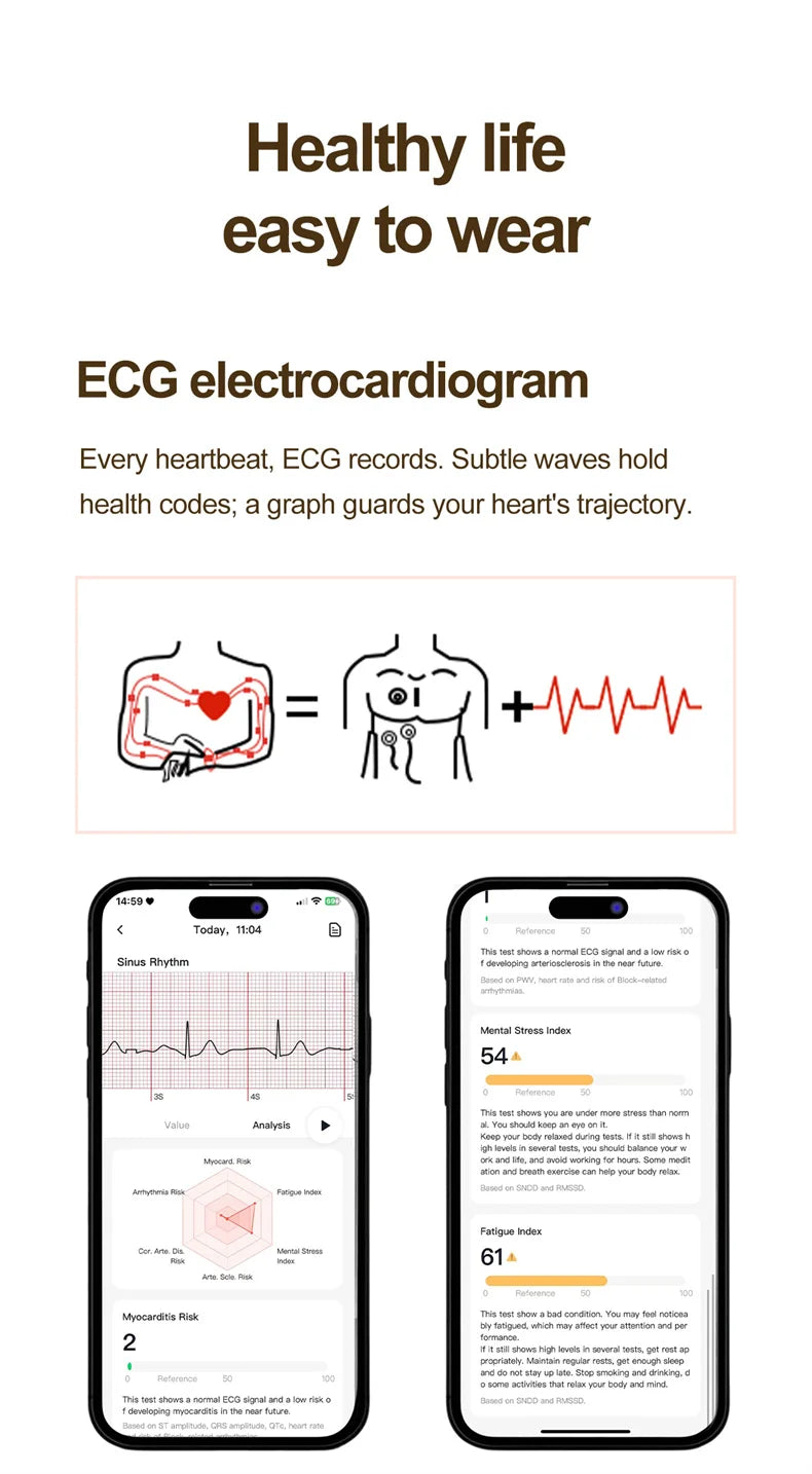 ECG Smart Watches Women 1.32 inch  AMOLED Screen Physical Examination Blood oxygen Pressure Fat Call Health ECG+PPG Smartwatch