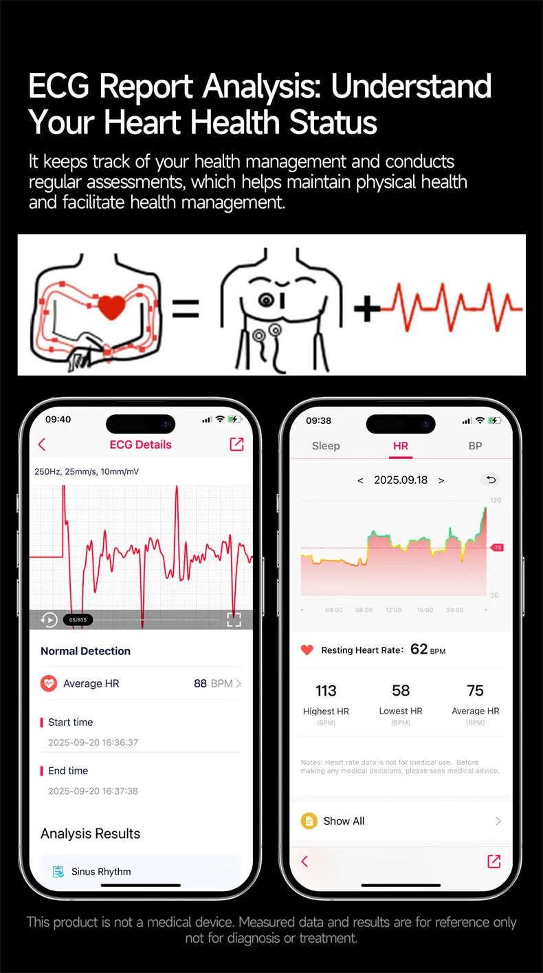 2026Nowość Zdrowie Sport EKG AI Diagnostyka Inteligentne Zegarki Męskie Tętno Ciśnienie Krwi IP68 Wodoodporne Smartwatche Dla Mężczyzn Kobiet