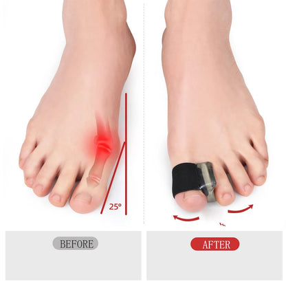 2PCS Big Bone Thumb Toe Separator Bunion Splint Straightener Corrector Foot Care Tools Hallux Valgus Protector Orthotics 1 Pair