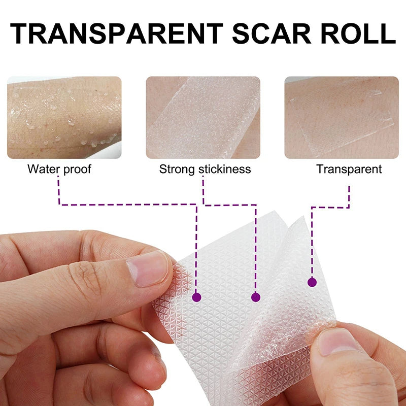 1.5M Silicone Scar Sheets Clear Scars Tape Strip Invisible Silicone Self-adhesive Patches for C-Section Surgery Keloid Burn Acne