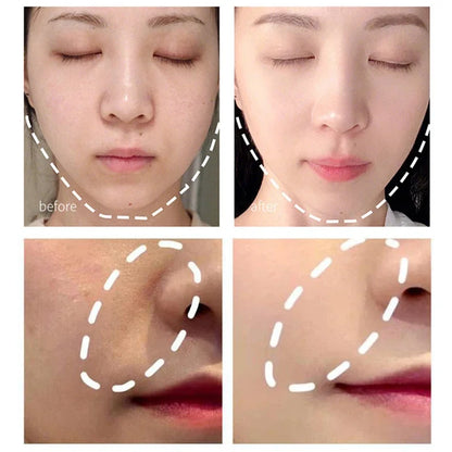 Electric Facial Beauty Devices Face Lifting Anti Wrinkle Facial Eye Massage with Face Cream Introducer Skin Rejuvenation Care