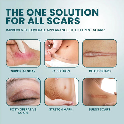 Z. 1 Roll Silicone Scar Sheets Gel Scar Patch 4cmX150cm Self-Adhesive Scar Cover Tape Reusable And Effective Skin Care Strips