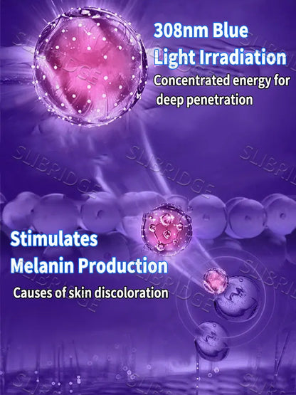 Vitiligo Treatment Device 2nd Upgraded Version⸴Vitiligo Treatment⸴Fast
