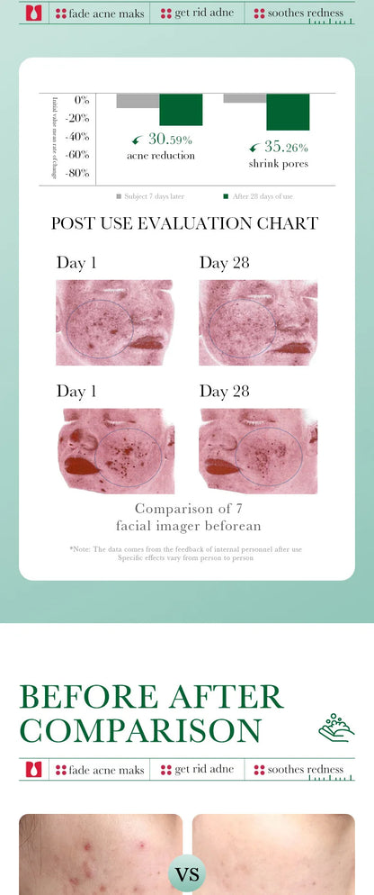 BIOAOUA Salicylic Acid Facial Cleanser Acne Treatment Moisturizing Oil Control Skincare Face Wash Foam Face Cleanser Skin Care