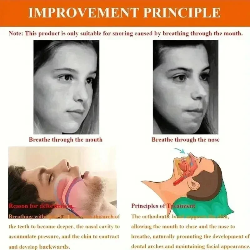 Anti Snoring Chin Strap Sleep Band, Mouth Breathing Corrector Reduce Snoring for Open Mouth Sleepers
