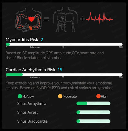 Smartwatch ECG High-End dla mężczyzn Ciśnienie krwi Lipidy Tlen we krwi Analiza ciała Kwas moczowy Monitor Zdrowia Smartwatch dla mężczyzn i kobiet