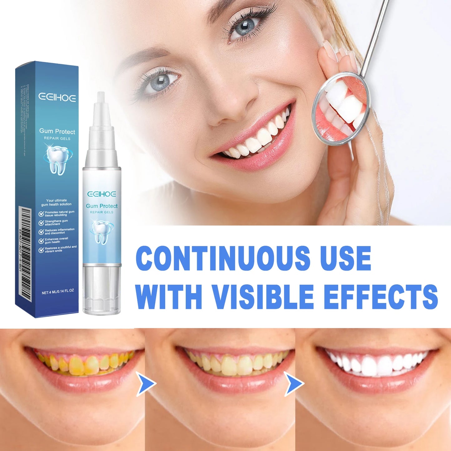 Damaged Gum Repair Care Gel Deep Cleaning Effectively Removes Yellow Teeth Stains Tartar Fresh Breath Teeth Cleaning Gel 4ml