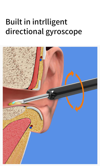 Smart Ear Wax Cleaner with Camera 3.5mm Earpick Otoscope Visual Ear Camera Health Care Ear Cleaner for iPhone, iPad, Android