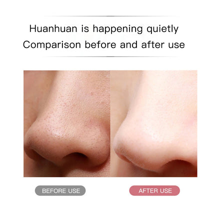 Ultrasonic Skin Scrubber Peeling Blackhead Remover Deep Face Cleaning Acne Pore Cleaner Facial Shovel Cleanser EMS Microcurrent