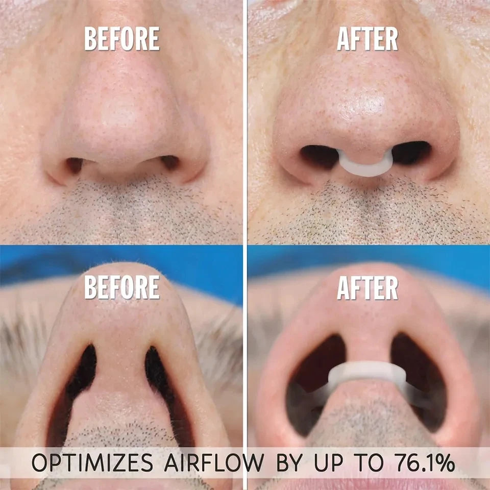 Silicone Nose Clip Anti-Snoring Nasal Dilator for Sleeping Breath Easier Snore Right Nasal Clip Improve Respiratory Comfort