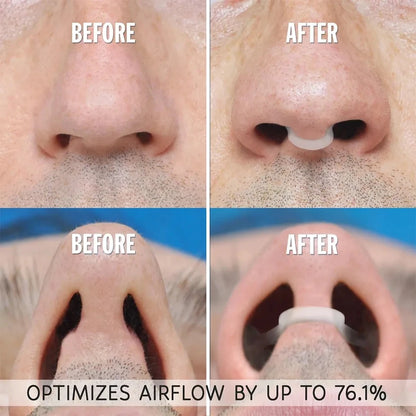 Silicone Nose Clip Anti-Snoring Nasal Dilator for Sleeping Breath Easier Snore Right Nasal Clip Improve Respiratory Comfort