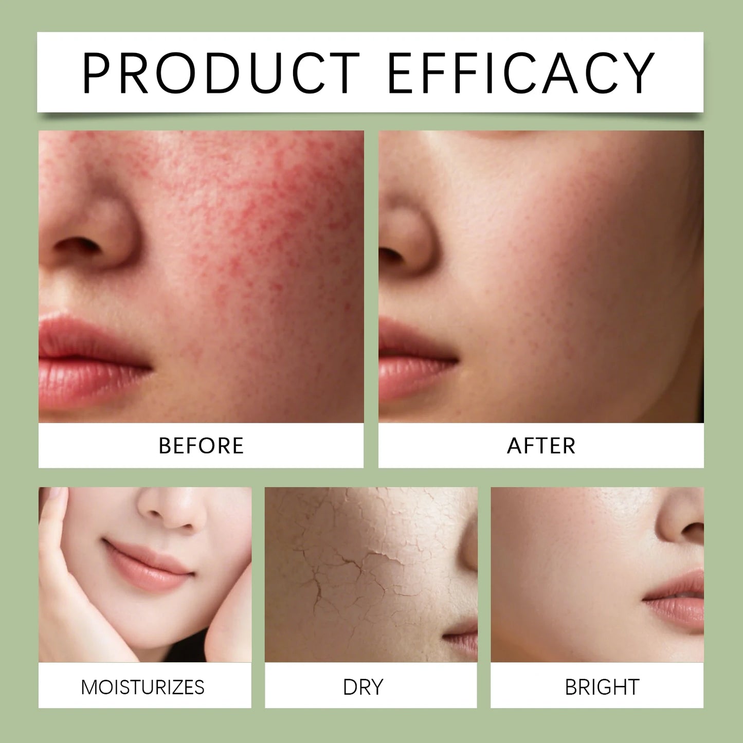 HOYGI Tea Tree Oil Soap Moisturizing Exfoliate Relieve Cleansing Soap Facial Cleansing Oil Control Moisturize Face Wash Skincare