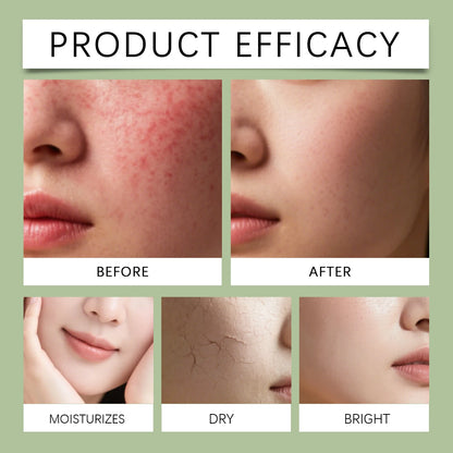 HOYGI Tea Tree Oil Soap Moisturizing Exfoliate Relieve Cleansing Soap Facial Cleansing Oil Control Moisturize Face Wash Skincare