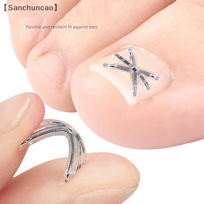 〔San〕2Pcs Ingrown Toenail Correction Tool Ingrown Toenail Treatments Elastic Patch Sticker Toenail Straightening Pedicure Tool