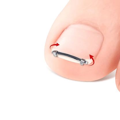 Ingrown Toenail Pedicure Tool Embed Toe Nail Care Straightening Correction Clip Curved Clamp Toenails Correction Tool For Toes