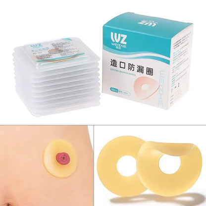 NEW NEW 10Pcs Baseplates Stoma Care Products To Protect Skin Anti-Leakage Ring For Colostomy Bag Ostomy Paste Ring