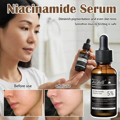 Teashell Serum 5% Niacinamide & Arbutin 30ml Fade Dark Spots Skin Moisturizing Hydration Sensitive Skin