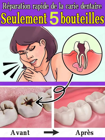 Rapid Relief Tooth Care Gel Comfort Oral Discomfort Clean Dental Plaque Maintain Fresh Breath Teeth Repair Paste For Daily Use