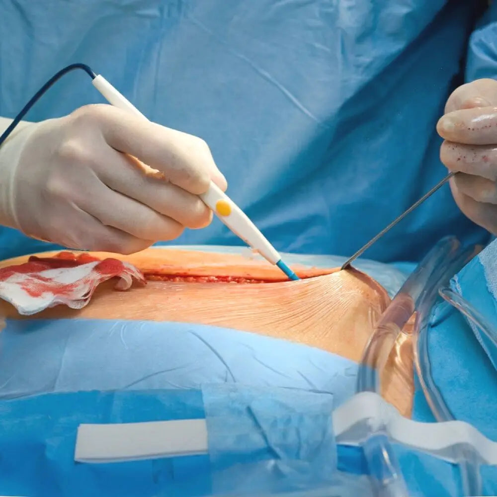 Tungsten Active Electrode High-frequency electrocautery Electrocoagulator 5cm/6cm/7cm Needle