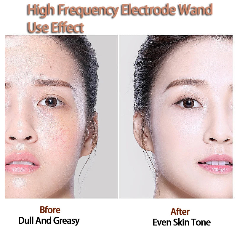 Replace HF Wand Spiral Electrode Glass Tube Argon Violet Ray Neon Acne Skin Care Face Body Massage