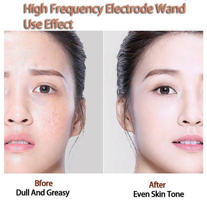 Replace HF Wand Spiral Electrode Glass Tube Argon Violet Ray Neon Acne Skin Care Face Body Massage