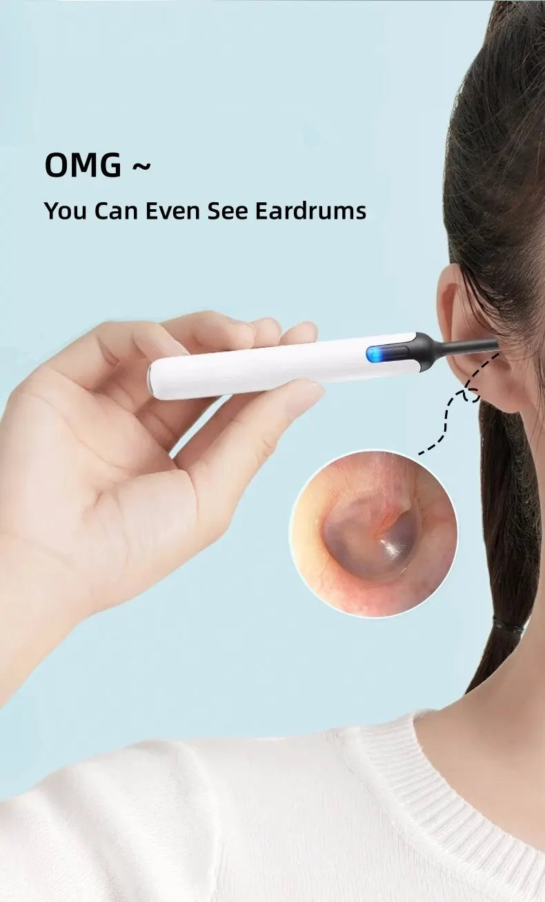 Bebird Xlife X0 Ear Cleaner Wax Remover Tool Smart Visual Stick Otoscope 1080P HD Earpick Endoscope Earring Personal Health Care