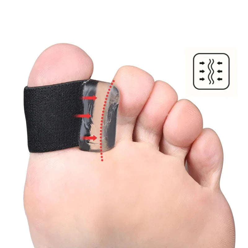 2PCS Big Bone Thumb Toe Separator Bunion Splint Straightener Corrector Foot Care Tools Hallux Valgus Protector Orthotics 1 Pair
