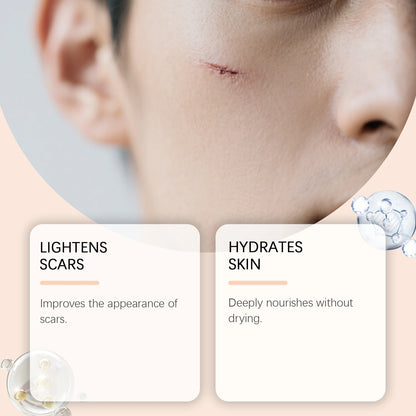 Centella Asiatica Scar Solution Stick Repair Blemishes Reduce Scar Visibility Restore Surface Barrier Portable Scar Repair Gel