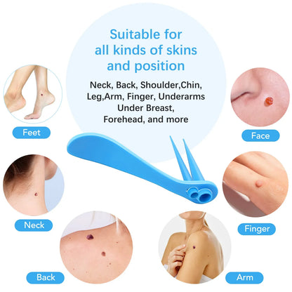 2-IN-1 Innovative Skin Tag Remover Kit Micro Skin Tag Removal Device Adult Mole Stain Wart Remover Face Care Beauty Tools