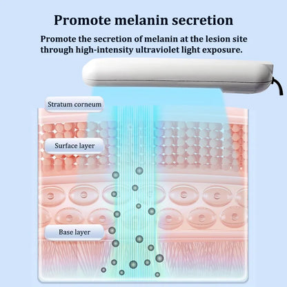 311NM UVB Phototherapy Lamp Device for Vitiligo Treatment UV NarrowBand Ultraviolet Light Therapy Psoriasis Spots Eczema