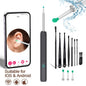 Smart Ear Wax Cleaner with Camera 3.5mm Earpick Otoscope Visual Ear Camera Health Care Ear Cleaner for iPhone, iPad, Android